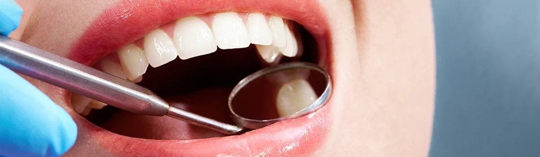 Dental Sealants in Orange City FL Dental Sealants in Orange City FL