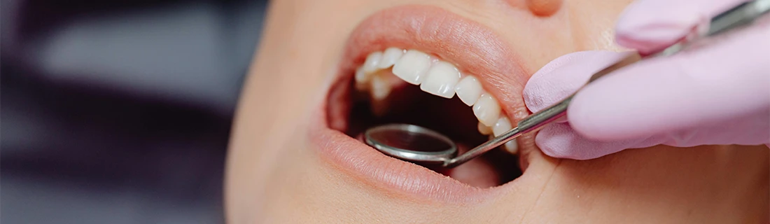 Oral Cancer Screening in Orange City FL Oral Cancer Screening in Orange City FL