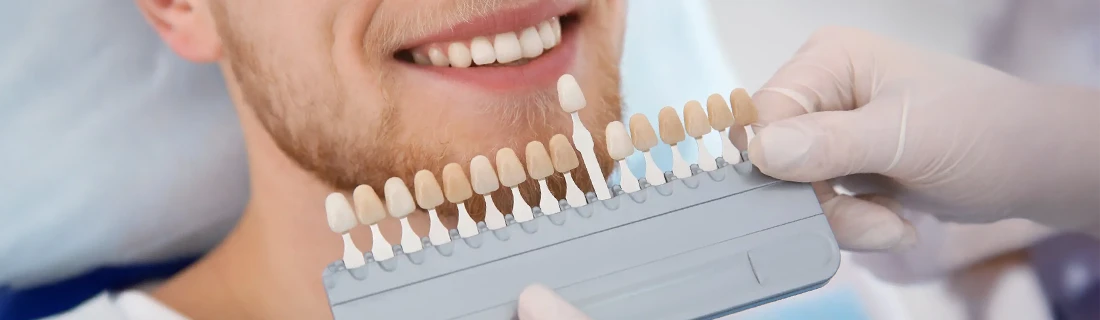 Porcelain Dental Veneers in Orange City FL Porcelain Dental Veneers in Orange City FL