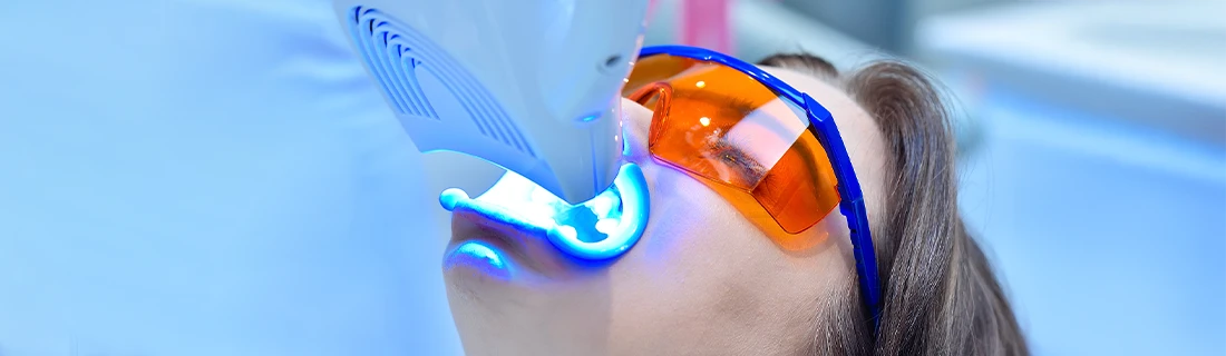 Professional Teeth Whitening in Orange City FL Professional Teeth Whitening in Orange City FL